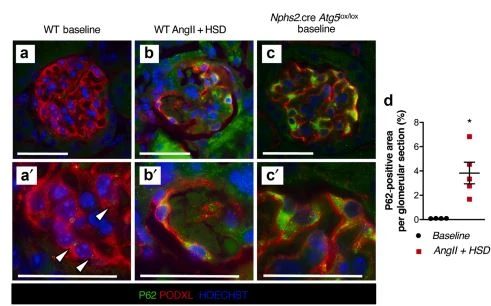 autophagy. autophagy.