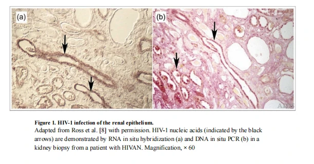 Figure 1 Figure 1