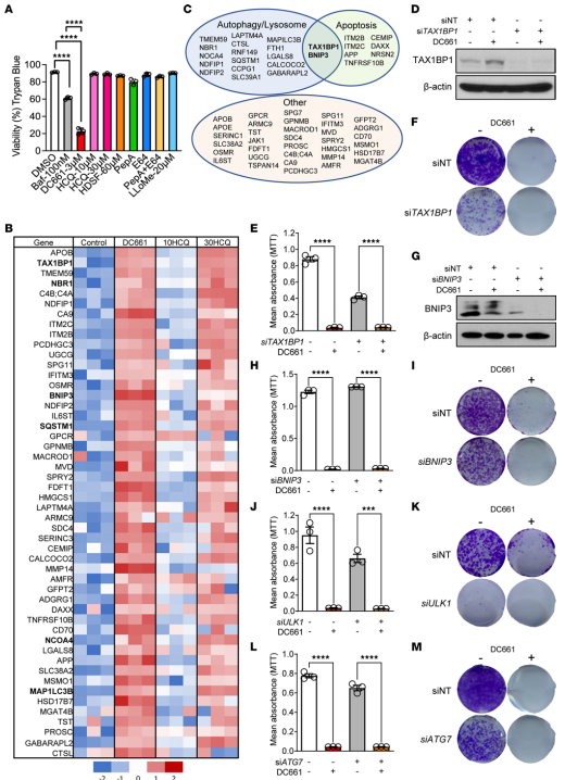 Figure 1. Lysosomal autophagy inhibition induces significant changes in apoptosis and autophagy proteins. (A)
